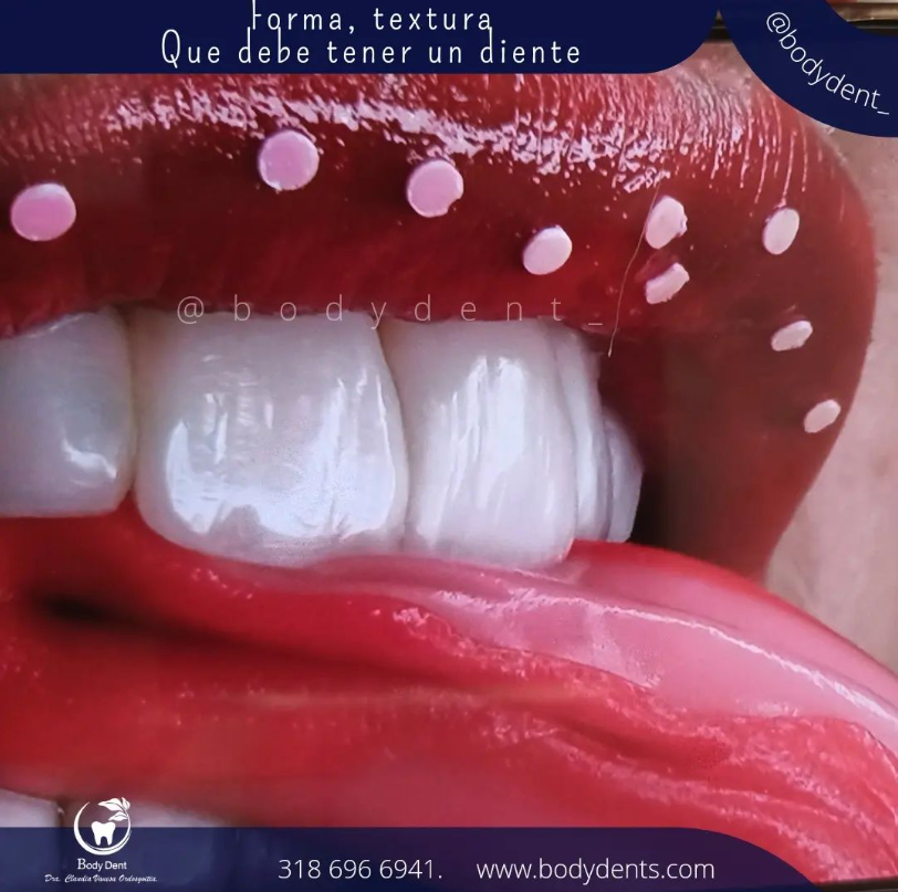 Diseño de sonrisa funcional