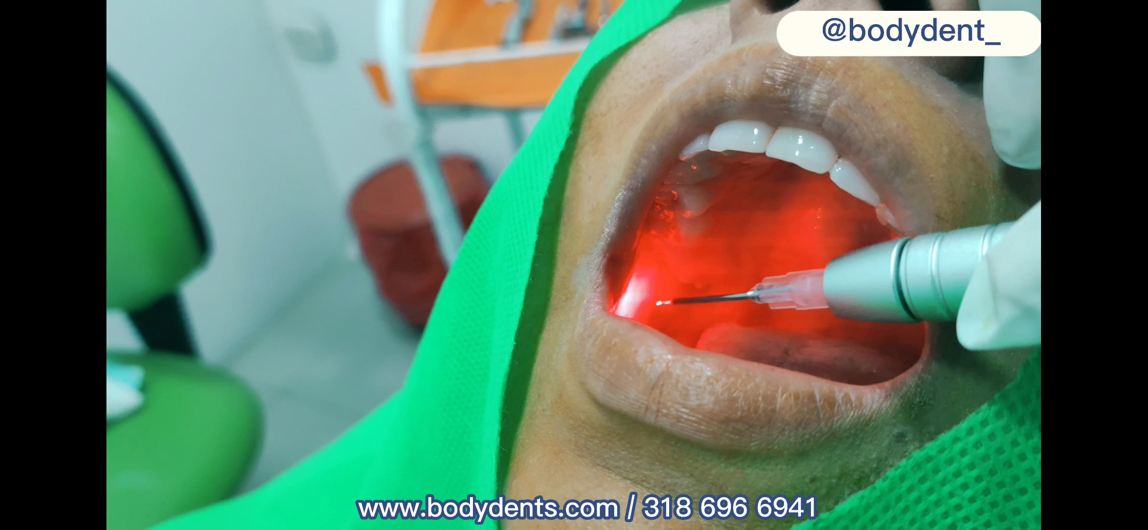 Tecnología láser odontológica
