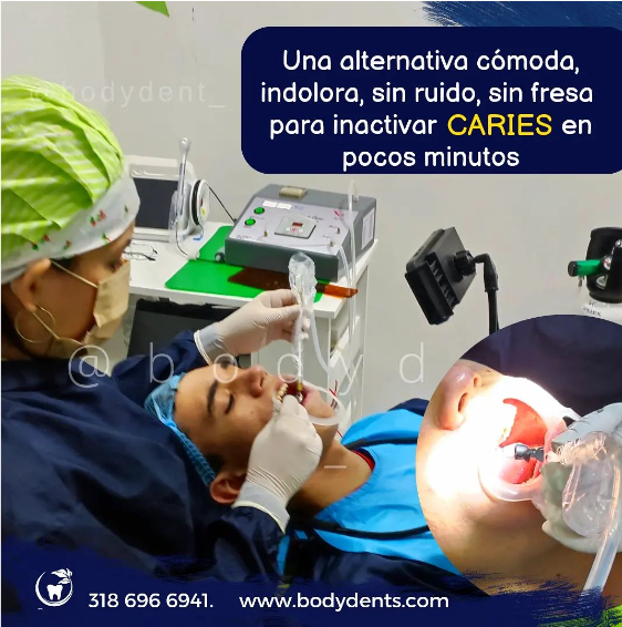 eliminar caries sin dolor