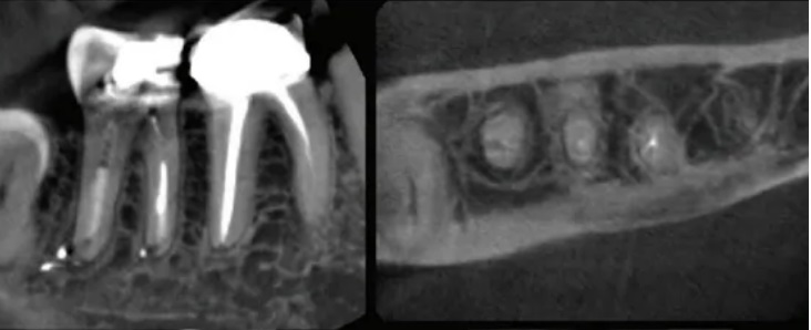 Endodoncia y odontología biológica, CBCT